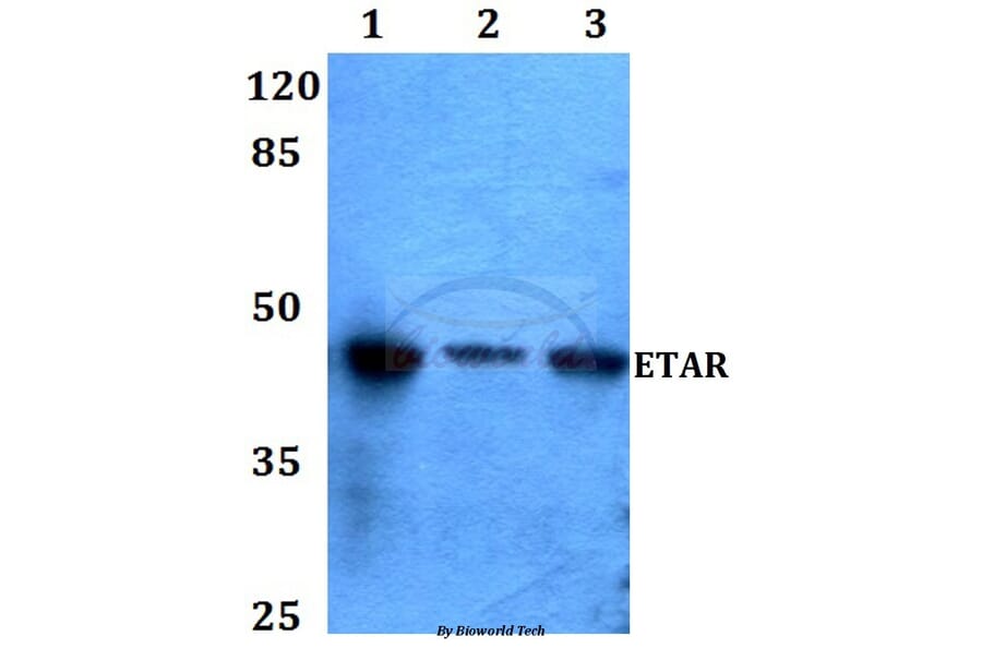 Anti-ETAR (N427) Antibody from Bioworld Technology (BS2597) - Antibodies.com