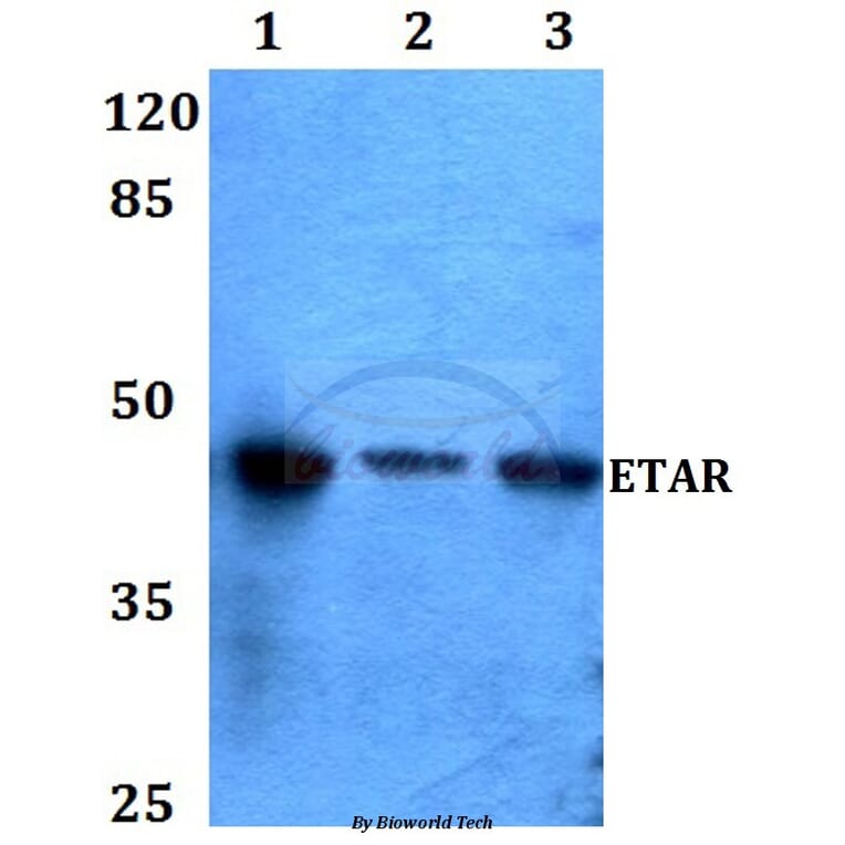 Anti-ETAR (N427) Antibody from Bioworld Technology (BS2597) - Antibodies.com