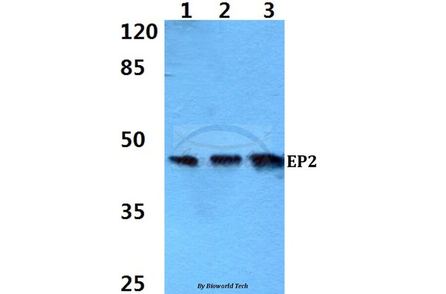 Anti-EP2 (Q299) Antibody from Bioworld Technology (BS2598) - Antibodies.com
