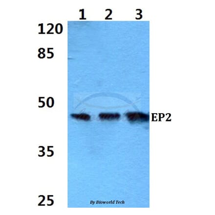 Anti-EP2 (Q299) Antibody from Bioworld Technology (BS2598) - Antibodies.com
