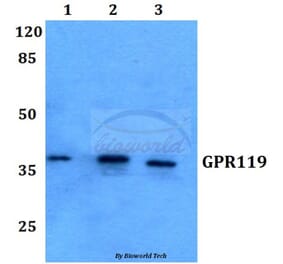 Anti-GPR119 (V227) Antibody from Bioworld Technology (BS2606) - Antibodies.com