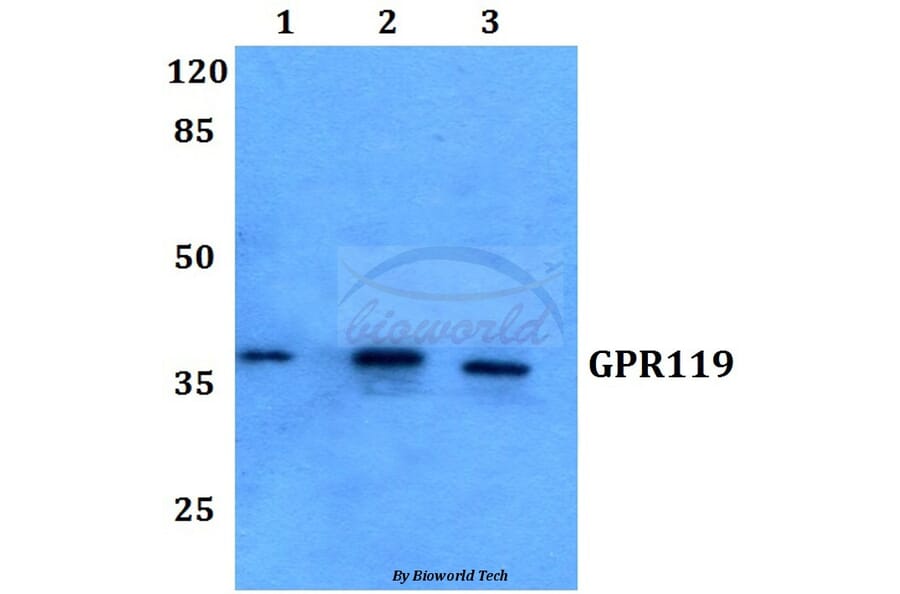 Anti-GPR119 (V227) Antibody from Bioworld Technology (BS2606) - Antibodies.com