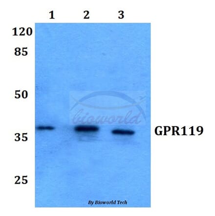 Anti-GPR119 (V227) Antibody from Bioworld Technology (BS2606) - Antibodies.com