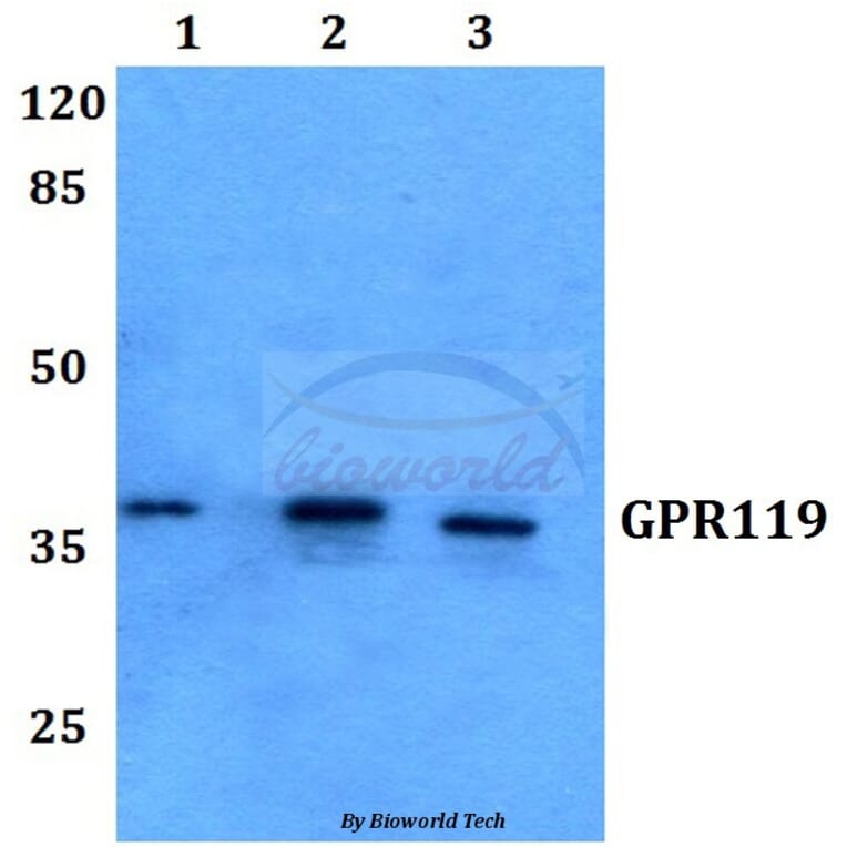 Anti-GPR119 (V227) Antibody from Bioworld Technology (BS2606) - Antibodies.com