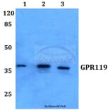 Anti-GPR119 (V227) Antibody from Bioworld Technology (BS2606) - Antibodies.com