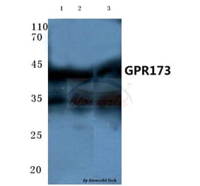 Anti-GPR173 (Y289) Antibody from Bioworld Technology (BS2610) - Antibodies.com