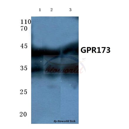 Anti-GPR173 (Y289) Antibody from Bioworld Technology (BS2610) - Antibodies.com