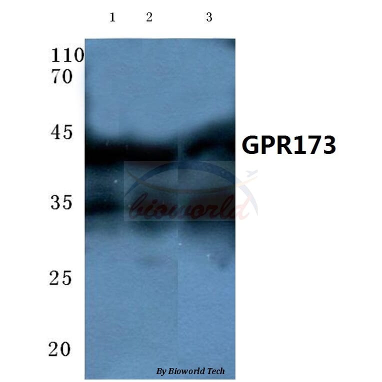 Anti-GPR173 (Y289) Antibody from Bioworld Technology (BS2610) - Antibodies.com