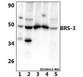 Anti-BRS-3 (E201) Antibody from Bioworld Technology (BS2612) - Antibodies.com