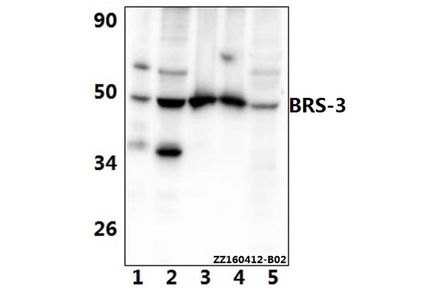 Anti-BRS-3 (E201) Antibody from Bioworld Technology (BS2612) - Antibodies.com