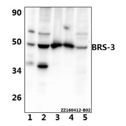 Anti-BRS-3 (E201) Antibody from Bioworld Technology (BS2612) - Antibodies.com