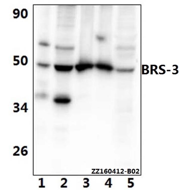 Anti-BRS-3 (E201) Antibody from Bioworld Technology (BS2612) - Antibodies.com