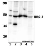 Anti-BRS-3 (E201) Antibody from Bioworld Technology (BS2612) - Antibodies.com