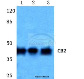 Anti-CB2 (R334) Antibody from Bioworld Technology (BS2615) - Antibodies.com