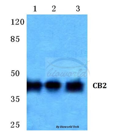 Anti-CB2 (R334) Antibody from Bioworld Technology (BS2615) - Antibodies.com
