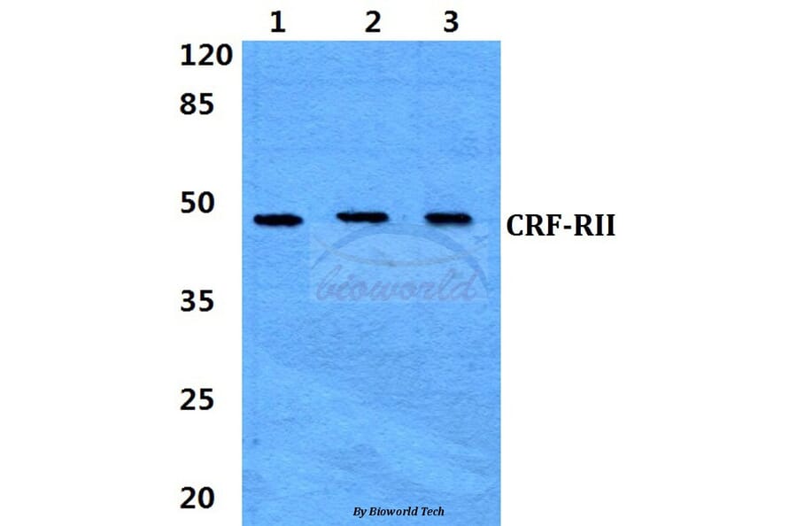 Anti-CRF-RII (H112) Antibody from Bioworld Technology (BS2616) - Antibodies.com