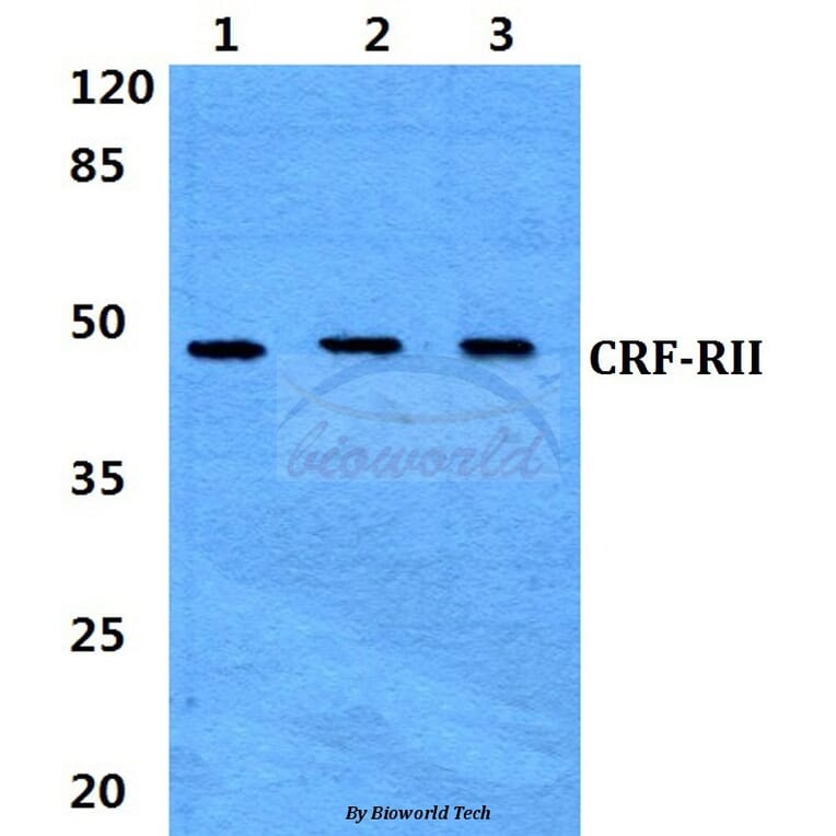 Anti-CRF-RII (H112) Antibody from Bioworld Technology (BS2616) - Antibodies.com