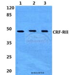 Anti-CRF-RII (H112) Antibody from Bioworld Technology (BS2616) - Antibodies.com