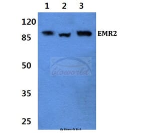 Anti-EMR2 (L160) Antibody from Bioworld Technology (BS2617) - Antibodies.com
