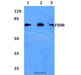 Anti-FSHR (R247) Antibody from Bioworld Technology (BS2618) - Antibodies.com