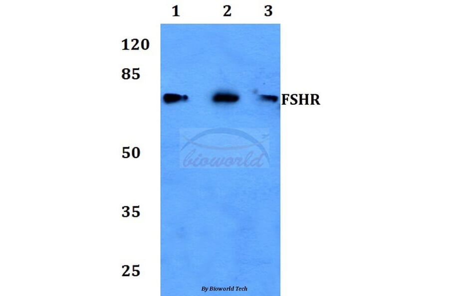 Anti-FSHR (R247) Antibody from Bioworld Technology (BS2618) - Antibodies.com