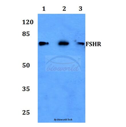 Anti-FSHR (R247) Antibody from Bioworld Technology (BS2618) - Antibodies.com