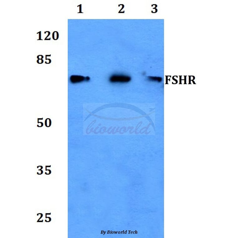 Anti-FSHR (R247) Antibody from Bioworld Technology (BS2618) - Antibodies.com