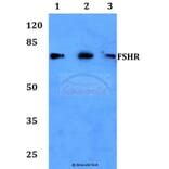 Anti-FSHR (R247) Antibody from Bioworld Technology (BS2618) - Antibodies.com