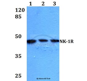 Anti-NK-1R (K245) Antibody from Bioworld Technology (BS2632) - Antibodies.com