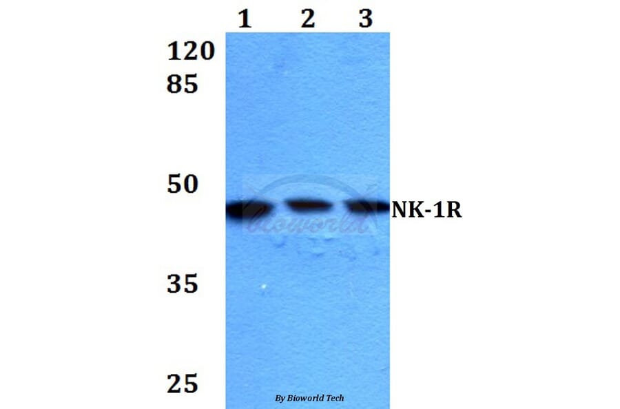 Anti-NK-1R (K245) Antibody from Bioworld Technology (BS2632) - Antibodies.com