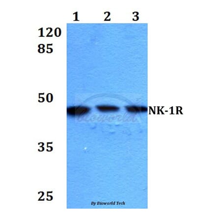 Anti-NK-1R (K245) Antibody from Bioworld Technology (BS2632) - Antibodies.com