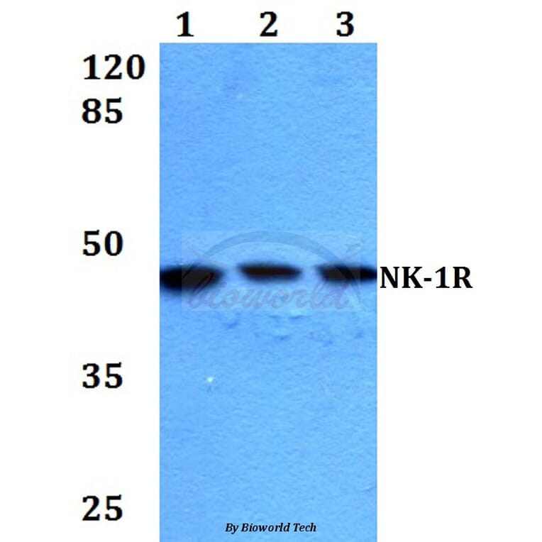 Anti-NK-1R (K245) Antibody from Bioworld Technology (BS2632) - Antibodies.com