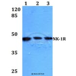 Anti-NK-1R (K245) Antibody from Bioworld Technology (BS2632) - Antibodies.com