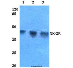 Anti-NK-2R (P340) Antibody from Bioworld Technology (BS2633) - Antibodies.com