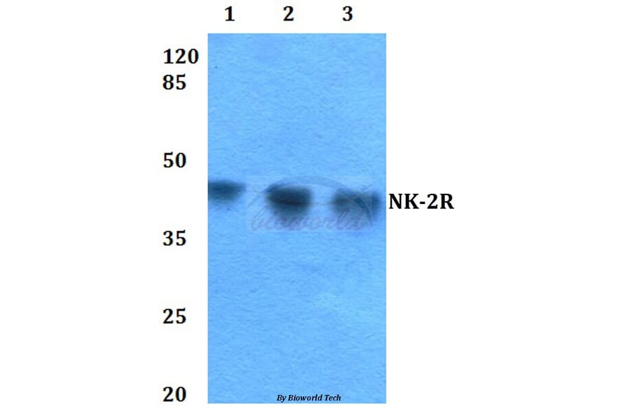 Anti-NK-2R (P340) Antibody from Bioworld Technology (BS2633) - Antibodies.com