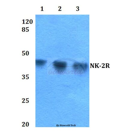 Anti-NK-2R (P340) Antibody from Bioworld Technology (BS2633) - Antibodies.com