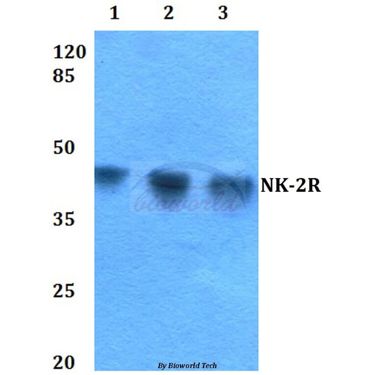 Anti-NK-2R (P340) Antibody from Bioworld Technology (BS2633) - Antibodies.com