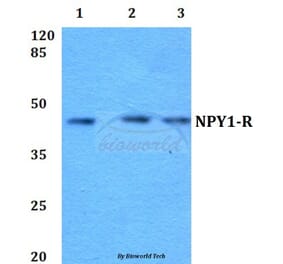 Anti-NPY1-R (R254) Antibody from Bioworld Technology (BS2634) - Antibodies.com