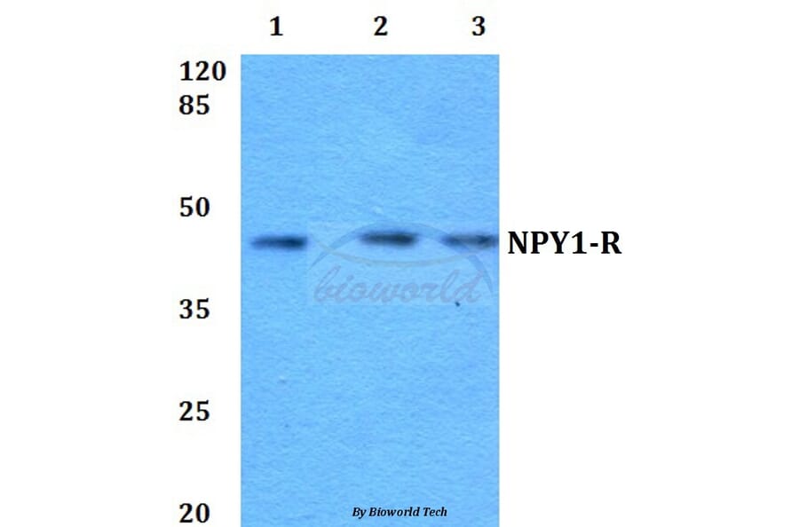Anti-NPY1-R (R254) Antibody from Bioworld Technology (BS2634) - Antibodies.com