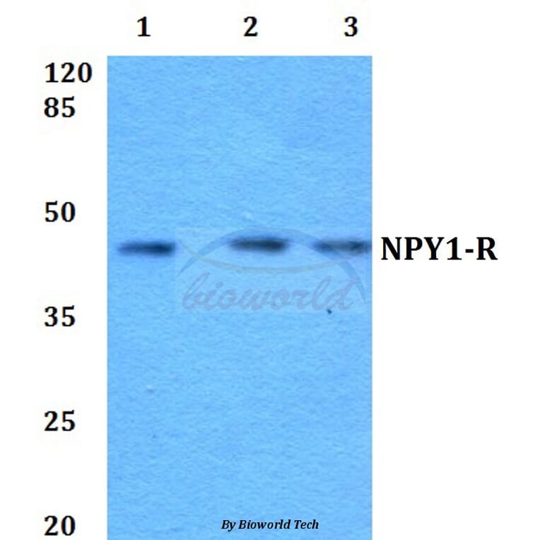 Anti-NPY1-R (R254) Antibody from Bioworld Technology (BS2634) - Antibodies.com