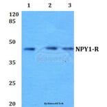 Anti-NPY1-R (R254) Antibody from Bioworld Technology (BS2634) - Antibodies.com