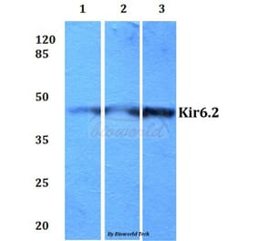 Anti-Kir6.2 (V220) Antibody from Bioworld Technology (BS2641) - Antibodies.com