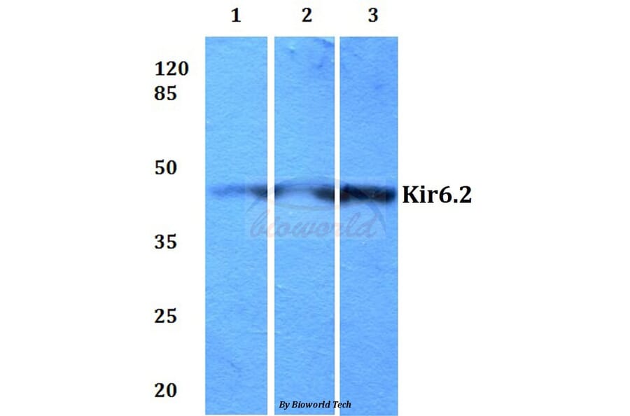 Anti-Kir6.2 (V220) Antibody from Bioworld Technology (BS2641) - Antibodies.com