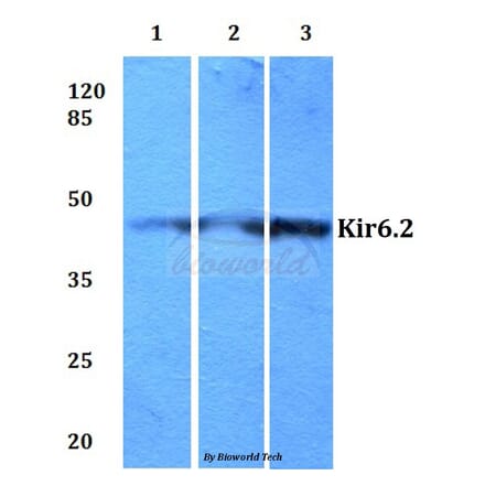 Anti-Kir6.2 (V220) Antibody from Bioworld Technology (BS2641) - Antibodies.com