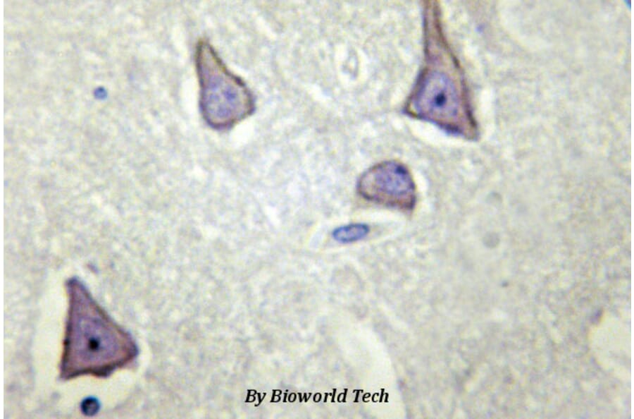 Anti-Kir6.2 (V220) Antibody from Bioworld Technology (BS2641) - Antibodies.com
