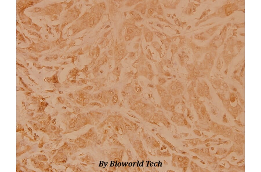 Anti-Topo IIα (E1102) Antibody from Bioworld Technology (BS2643) - Antibodies.com