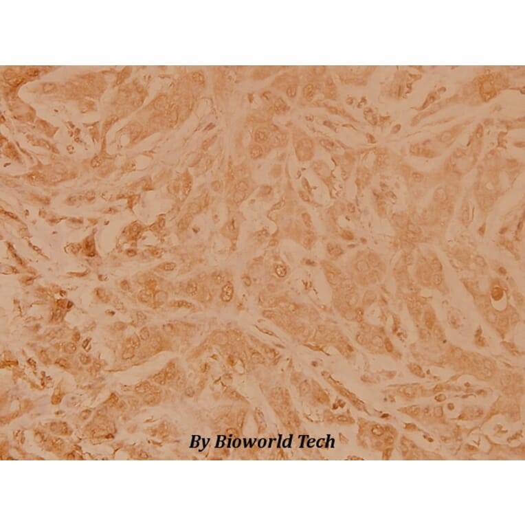 Anti-Topo IIα (E1102) Antibody from Bioworld Technology (BS2643) - Antibodies.com