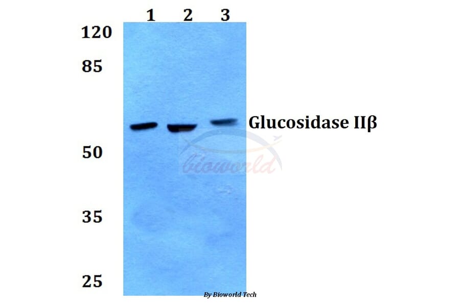 Anti-Glucosidase IIβ (K117) Antibody from Bioworld Technology (BS2646) - Antibodies.com