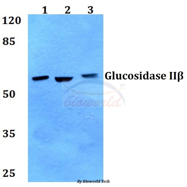Anti-Glucosidase IIβ (K117) Antibody from Bioworld Technology (BS2646) - Antibodies.com