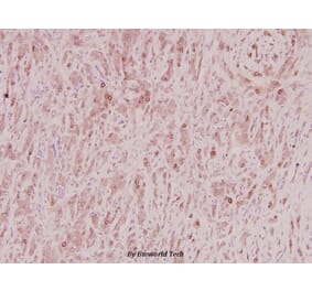 Anti-ZNF23 (Q185) Antibody from Bioworld Technology (BS2647) - Antibodies.com